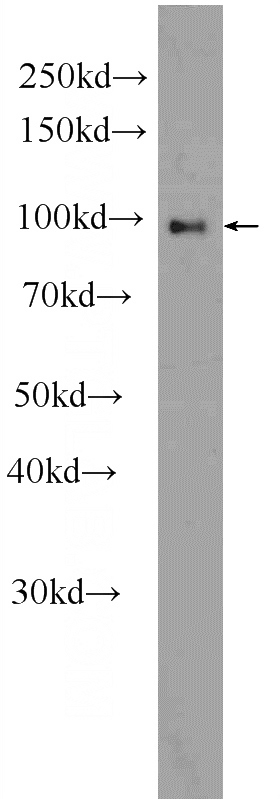 mouse liver tissue were subjected to SDS PAGE followed by western blot with Catalog No:110003(DMGDH Antibody) at dilution of 1:3000