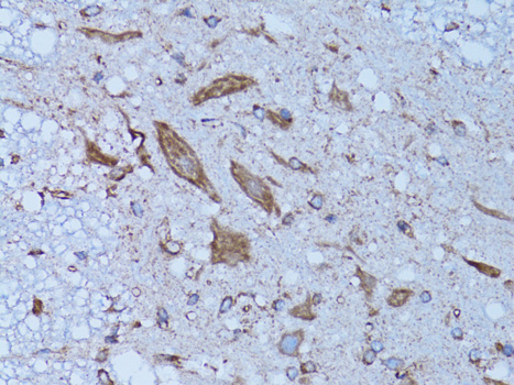 Immunohistochemistry - HADH Polyclonal Antibody 