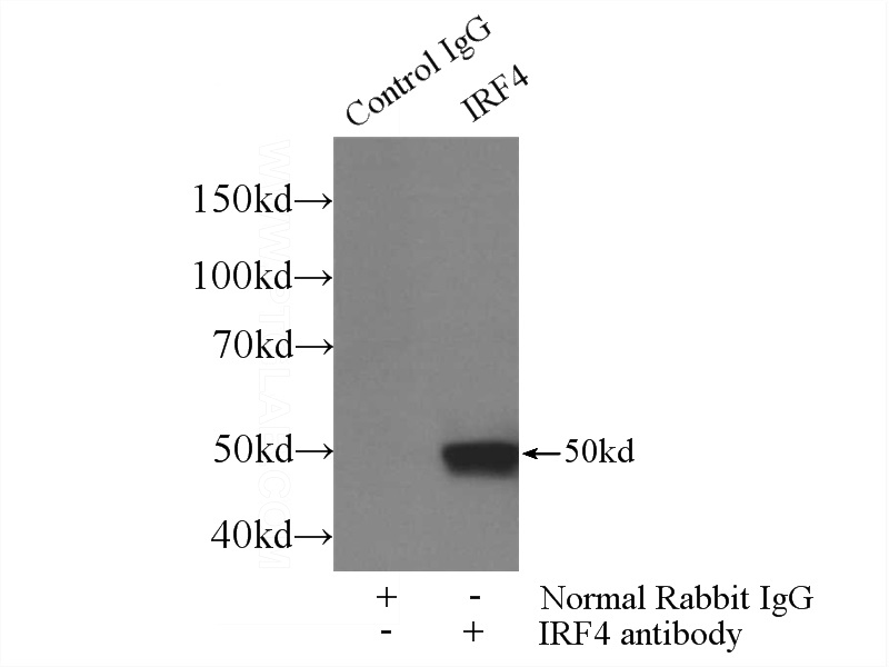 IP Result of anti-IRF4 (IP:Catalog No:111836, 3ug; Detection:Catalog No:111836 1:500) with mouse spleen tissue lysate 4000ug.