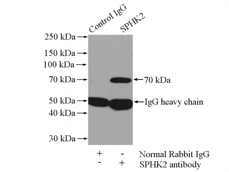 IP Result of anti-SPHK2 (IP:Catalog No:115567, 4ug; Detection:Catalog No:115567 1:800) with mouse liver tissue lysate 4000ug.