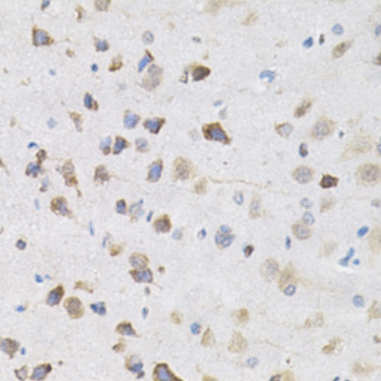 Immunohistochemistry - KPNA4 Polyclonal Antibody 