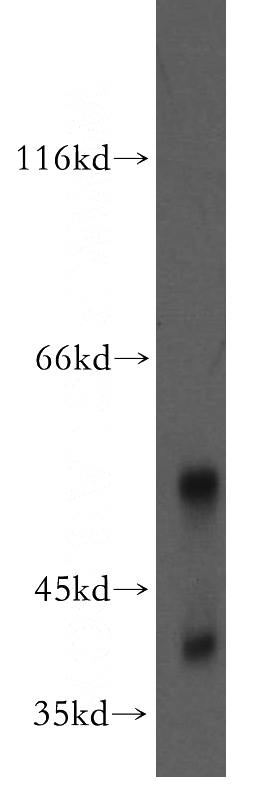 mouse testis tissue were subjected to SDS PAGE followed by western blot with Catalog No:109137(CD72 antibody) at dilution of 1:300