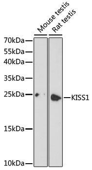 Western blot - KISS1 Polyclonal Antibody 