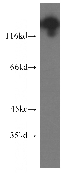 human brain tissue were subjected to SDS PAGE followed by western blot with Catalog No:107324(NCAM1 antibody) at dilution of 1:1000