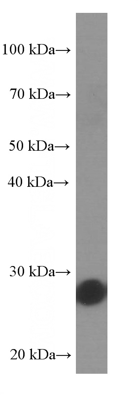 fetal human brain tissue were subjected to SDS PAGE followed by western blot with Catalog No:107531(UCHL1 Antibody) at dilution of 1:20000