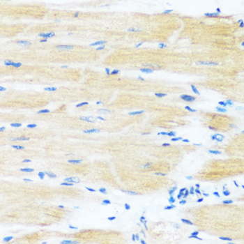 Immunohistochemistry - APOBEC3F Polyclonal Antibody 