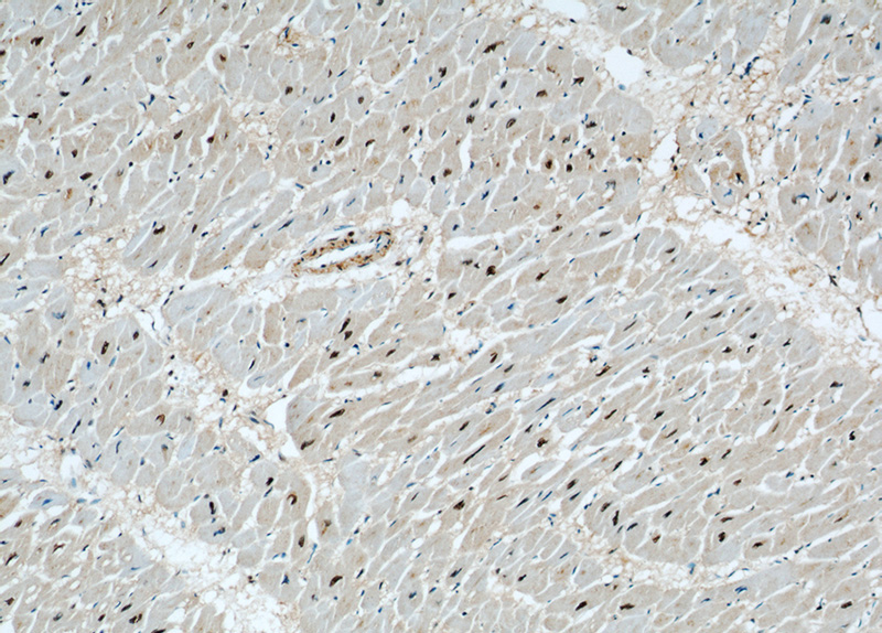 Immunohistochemical of paraffin-embedded human heart using Catalog No:115712(STK17A antibody) at dilution of 1:50 (under 10x lens)