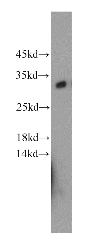 mouse skeletal muscle tissue were subjected to SDS PAGE followed by western blot with Catalog No:112019(KCTD14 antibody) at dilution of 1:400
