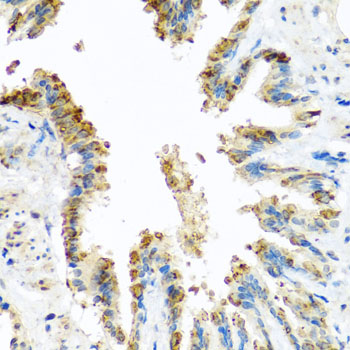 Immunohistochemistry - BCKDK Polyclonal Antibody 