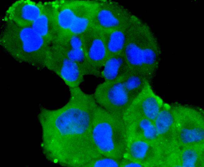 Fig2: Immunocytochemical staining of PANC-1 cells using anti-TMEM39a rabbit polyclonal antibody.