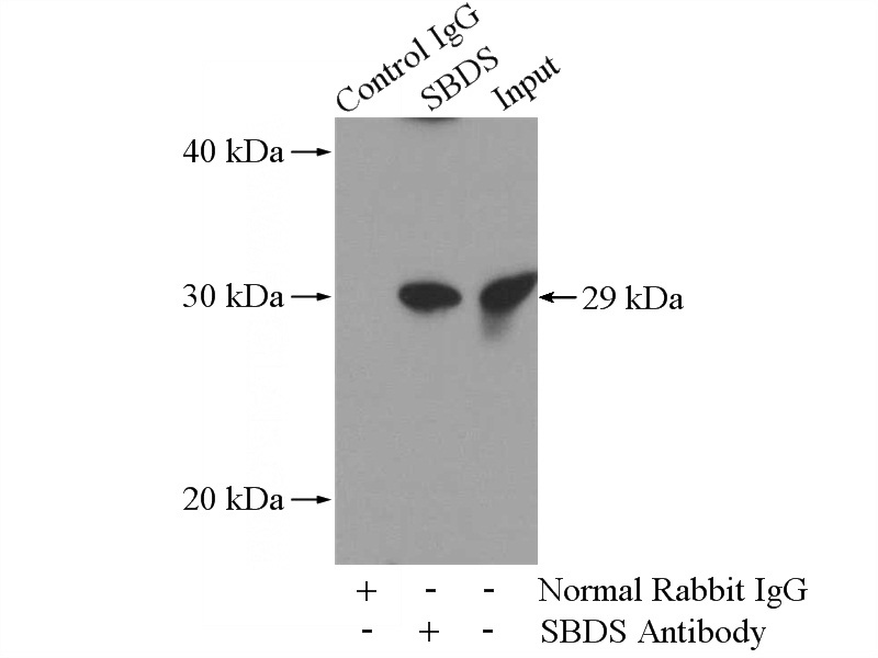 IP Result of anti-SBDS (IP:Catalog No:114979, 4ug; Detection:Catalog No:114979 1:300) with HL-60 cells lysate 3040ug.