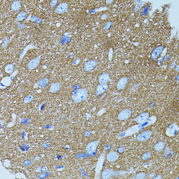 Immunohistochemistry - STX1A Polyclonal Antibody 