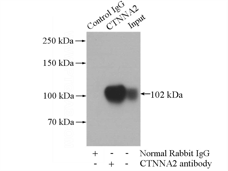 IP Result of anti-CTNNA2 (IP:Catalog No:107872, 4ug; Detection:Catalog No:107872 1:500) with SH-SY5Y cells lysate 1600ug.