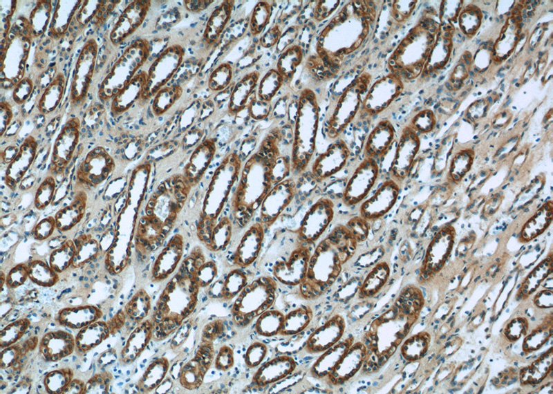 Immunohistochemistry of paraffin-embedded human kidney tissue slide using Catalog No:116757(VIPR1 Antibody) at dilution of 1:50 (under 10x lens)