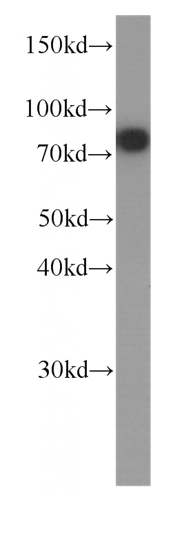 HeLa cells were subjected to SDS PAGE followed by western blot with Catalog No:107549(ZYX antibody) at dilution of 1:1000