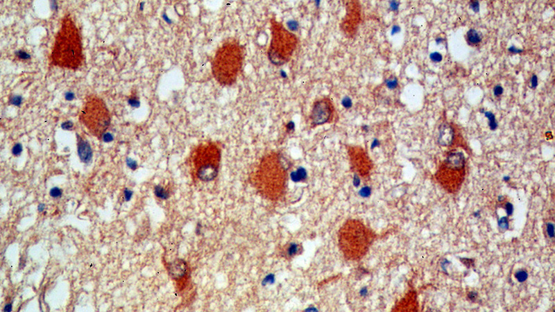 Immunohistochemical of paraffin-embedded human brain using Catalog No:111384(HDDC2 antibody) at dilution of 1:100 (under 40x lens)