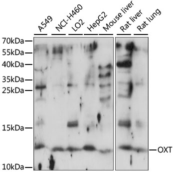Western blot - OXT Polyclonal Antibody 