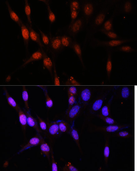 Immunofluorescence - KAT6A Polyclonal Antibody 