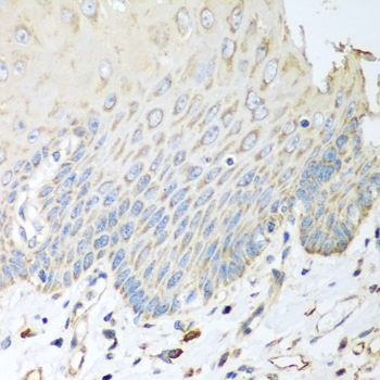 Immunohistochemistry - SGCB Polyclonal Antibody 
