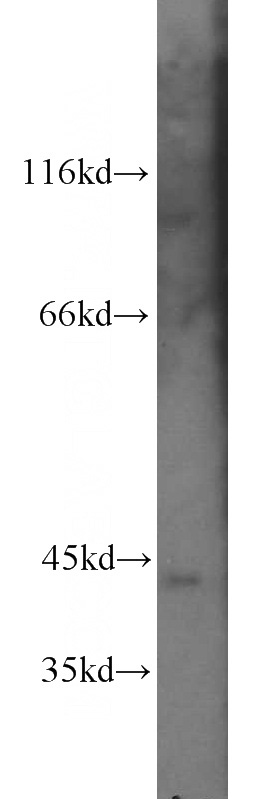 Jurkat cells were subjected to SDS PAGE followed by western blot with Catalog No:114204(PRKX antibody) at dilution of 1:500