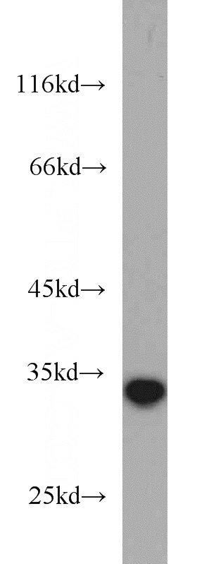 human skeletal muscle tissue were subjected to SDS PAGE followed by western blot with Catalog No:113393(NT5C3 antibody) at dilution of 1:500