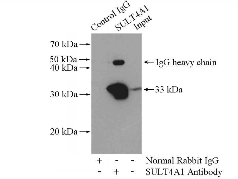 IP Result of anti-SULT4A1 (IP:Catalog No:115833, 4ug; Detection:Catalog No:115833 1:300) with mouse brain tissue lysate 4000ug.