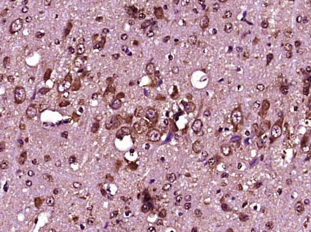Fig4: Paraformaldehyde-fixed, paraffin embedded (Mouse brain); Antigen retrieval by boiling in sodium citrate buffer (pH6.0) for 15min; Block endogenous peroxidase by 3% hydrogen peroxide for 20 minutes; Blocking buffer (normal goat serum) at 37℃ for 30min; Antibody incubation with (IL12) Polyclonal Antibody, Unconjugated at 1:400 overnight at 4℃, followed by operating according to SP Kit(Rabbit) (sp-0023) instructions and DAB staining.