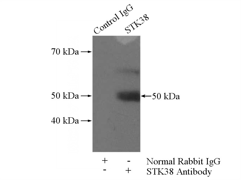 IP Result of anti-STK38 (IP:Catalog No:115722, 4ug; Detection:Catalog No:115722 1:300) with MCF-7 cells lysate 800ug.
