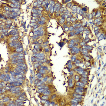 Immunohistochemistry - QARS Polyclonal Antibody 