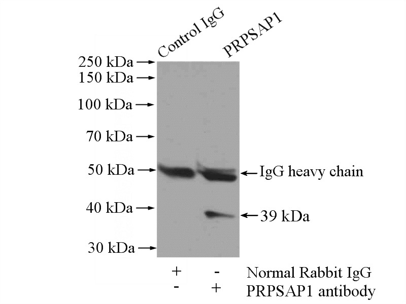 IP Result of anti-PRPSAP1 (IP:Catalog No:114239, 4ug; Detection:Catalog No:114239 1:300) with mouse testis tissue lysate 4000ug.
