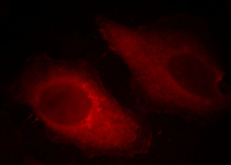 Immunofluorescent analysis of Hela cells, using CFL1 antibody Catalog No: at 1:50 dilution and Rhodamine-labeled goat anti-mouse IgG (red). Blue pseudocolor = DAPI (fluorescent DNA dye).