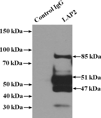 IP Result of anti-TMPO (IP:Catalog No:112141, 4ug; Detection:Catalog No:112141 1:500) with HeLa cells lysate 1600ug.