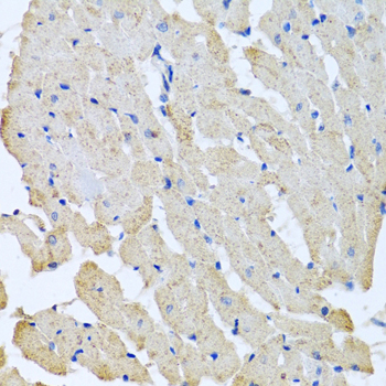 Immunohistochemistry - GPLD1 Polyclonal Antibody 