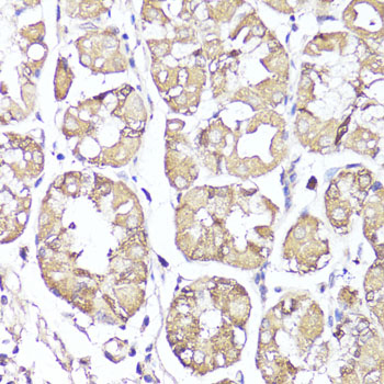 Immunohistochemistry - OPRK1 Polyclonal Antibody 