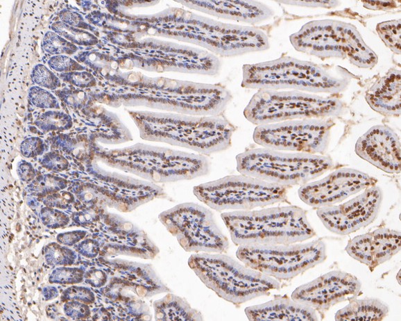 Fig3:; Immunohistochemical analysis of paraffin-embedded mouse colon cancer tissue using anti-Histone H3 antibody. The section was pre-treated using heat mediated antigen retrieval with sodium citrate buffer (pH 6.0) for 20 minutes. The tissues were blocked in 5% BSA for 30 minutes at room temperature, washed with ddH; 2; O and PBS, and then probed with the primary antibody ( 1/400) for 30 minutes at room temperature. The detection was performed using an HRP conjugated compact polymer system. DAB was used as the chromogen. Tissues were counterstained with hematoxylin and mounted with DPX.