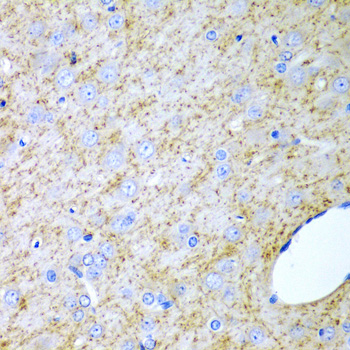 Immunohistochemistry - INHA Polyclonal Antibody 
