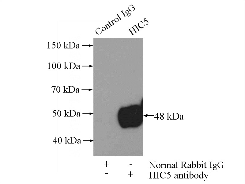 IP Result of anti-TGFB1I1 (IP:Catalog No:111344, 4ug; Detection:Catalog No:111344 1:500) with A431 cells lysate 1520ug.