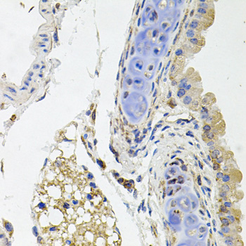 Immunohistochemistry - SDC2 Polyclonal Antibody 