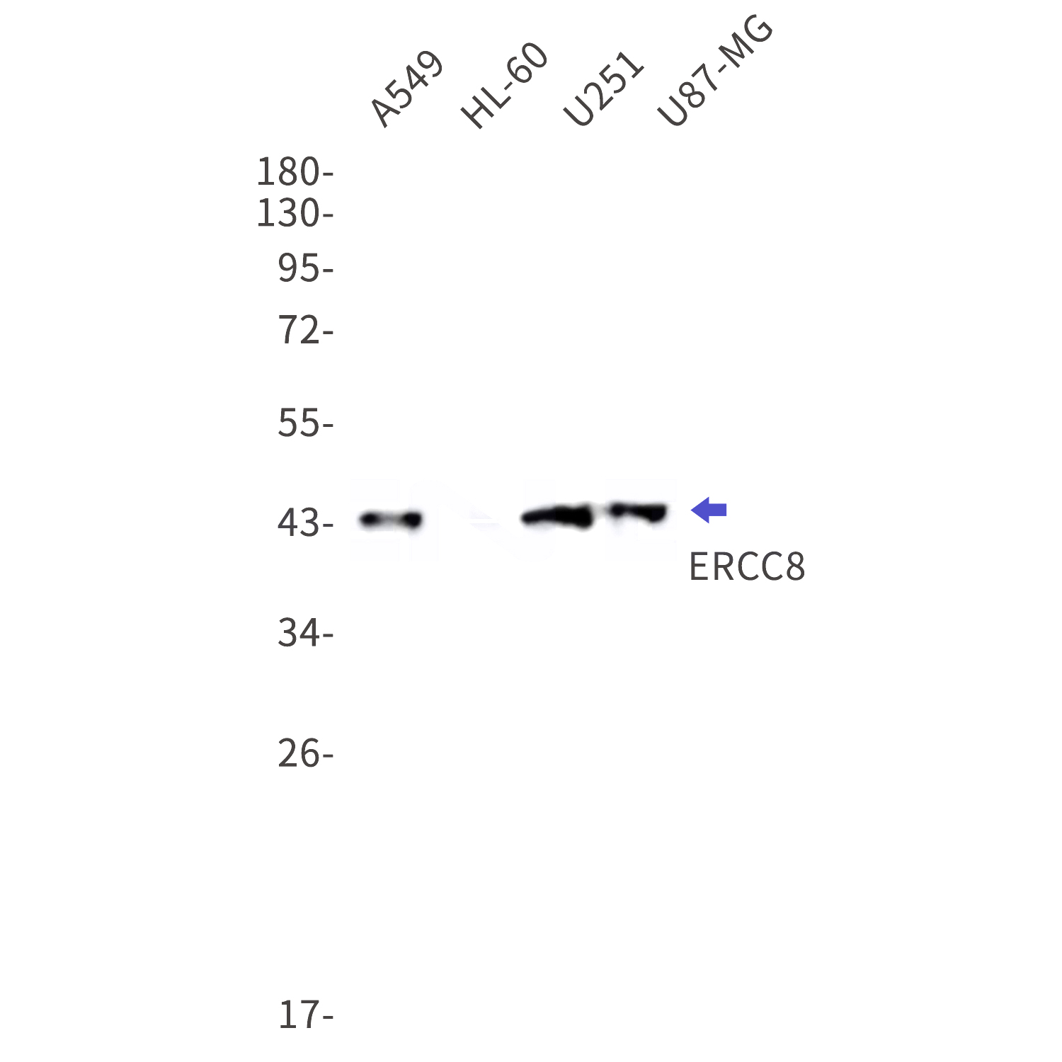 Western blot detection of ERCC8 in A549,HL-60,U251,U87-MG cell lysates using ERCC8 Rabbit mAb(1:1000 diluted).Predicted band size:44kDa.Observed band size:44kDa.