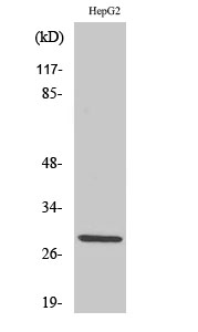 Fig1:; Western Blot analysis of various cells using Spi-C Polyclonal Antibody cells nucleus extracted by Minute TM Cytoplasmic and Nuclear Fractionation kit (SC-003,Inventbiotech,MN,USA).