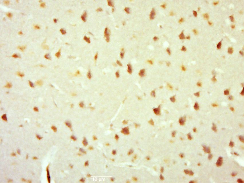 Fig2: Paraformaldehyde-fixed, paraffin embedded (Mouse brain); Antigen retrieval by boiling in sodium citrate buffer (pH6.0) for 15min; Block endogenous peroxidase by 3% hydrogen peroxide for 20 minutes; Blocking buffer (normal goat serum) at 37℃ for 30min; Antibody incubation with (Histone H1.X) Polyclonal Antibody, Unconjugated at 1:500 overnight at 4℃, followed by a conjugated secondary (sp-0023) for 20 minutes and DAB staining.