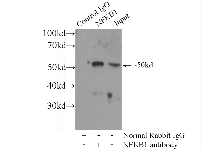 IP Result of anti-NFKB1 (IP:Catalog No:113169, 3ug; Detection:Catalog No:113169 1:500) with Jurkat cells lysate 1800ug.