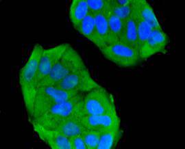 Fig1: Immunocytochemical staining of Hela cells using anti-FPR2 rabbit polyclonal antibody.