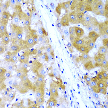 Immunohistochemistry - TIRAP Polyclonal Antibody 