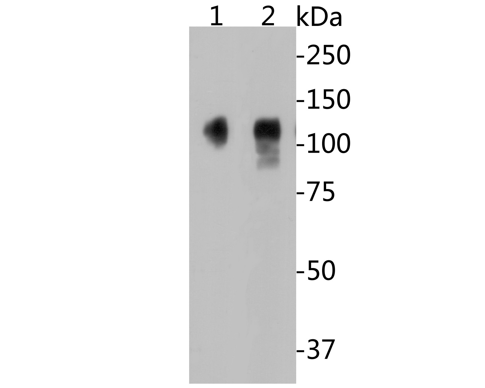 Fig1:; Western blot analysis of CD68 on different lysates. Proteins were transferred to a PVDF membrane and blocked with 5% BSA in PBS for 1 hour at room temperature. The primary antibody ( 1/500) was used in 5% BSA at room temperature for 2 hours. Goat Anti-Mouse IgG - HRP Secondary Antibody (HA1001) at 1:5,000 dilution was used for 1 hour at room temperature.; Positive control:; Lane 1: A431 cell lysate; Lane 2: THP-1 cell lysate