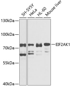 Western blot - EIF2AK1 Polyclonal Antibody 