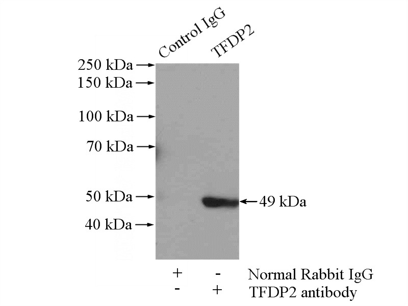 IP Result of anti-TFDP2 (IP:Catalog No:116007, 4ug; Detection:Catalog No:116007 1:400) with SH-SY5Y cells lysate 1600ug.