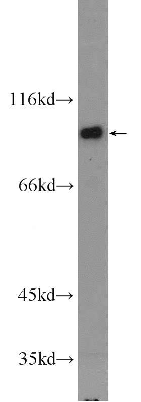 NIH/3T3 cells were subjected to SDS PAGE followed by western blot with Catalog No:111671(IFT80 Antibody) at dilution of 1:1000