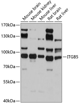 Western blot - ITGB5 Polyclonal Antibody 