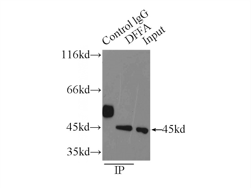 IP Result of anti-DFFA,DFF45 (IP:Catalog No:109901, 3ug; Detection:Catalog No:109901 1:1000) with HEK-293 cells lysate 2500ug.